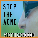 Stop The Acne : Official blog of stoptheacne.com