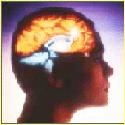 Brain Stimulant : 