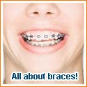 Orthodontics Today: all about braces : metal braces, Damon, ceramics, lingual, invisible braces. All about them