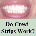 Crest Whitestrips Review : Do Crest Whitestrips Whiten Teeth?