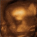 Bambino Ezekiel : 