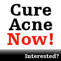 To Cure Acne... : 